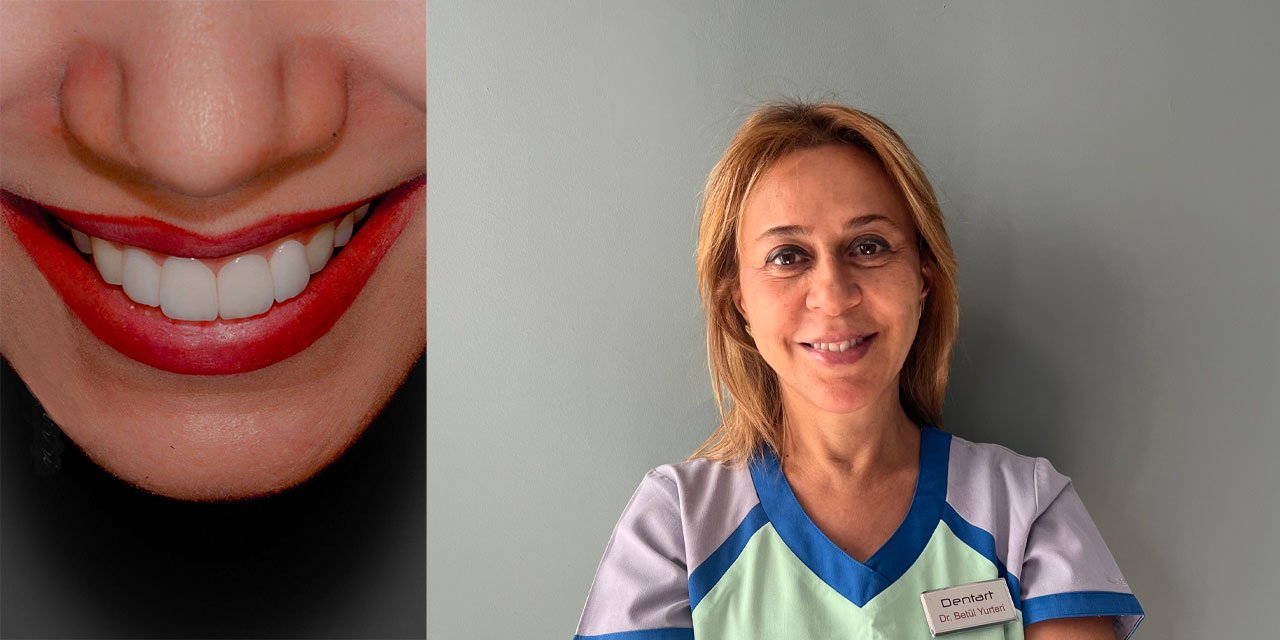Hassas Dişlere Yönelik Gelişmiş Diş Beyazlatma Teknolojisi